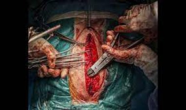 Kalp ameliyatlarının yüzde 30'u  'kan yokluğundan' erteleniyor