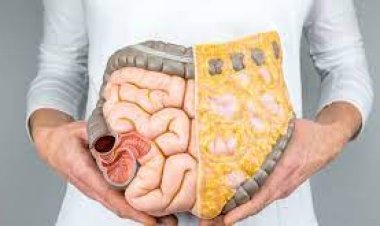 Kolon kanseri gençlerin hastalığı oluyor!