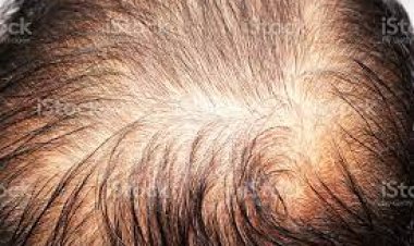 Evcil hayvan sebep olabilir