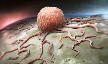 Uzmanları uyardı: 50 yaş altı kanser vakaları artıyor