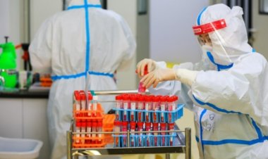 Covid-19’dan 100 kat daha kötü bir virüs yayılıyor