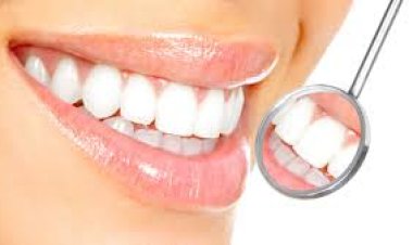 Bilinçsiz diş beyazlatmalara dikkat !