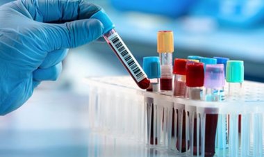 Türk doktorun mucize keşfi