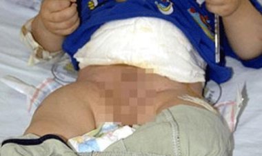 Yanlış sünnet hayat kararttı, 7 yaşındaki  çocuğun cinsel organı kesildi: 3 gözaltı