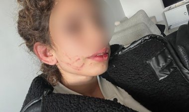 Konya’da 19 yaşındaki kızı darp eden gençten  “kendi kendini yaraladı” savunması