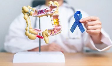 Kolon kanseri artışta: Uzmanlardan 'yoğurt' önerisi