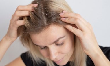 Saç Derisinde Kabuklanma Neden Olur ve Nasıl Geçer?